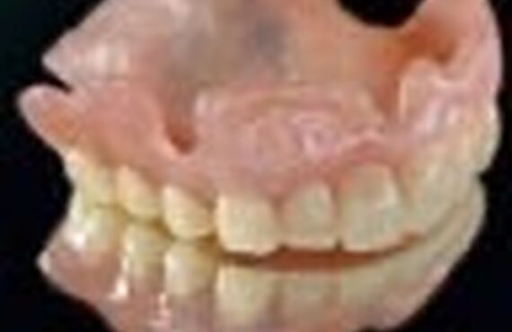 Provisional denture for the two-stage approach considering alveolar ridge atorophy, 歯科技工所をお探しでしたらイメージプロダクツ